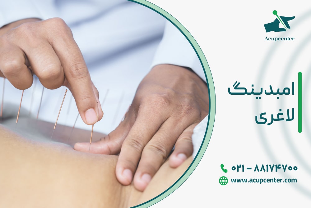 امبدینگ لاغری