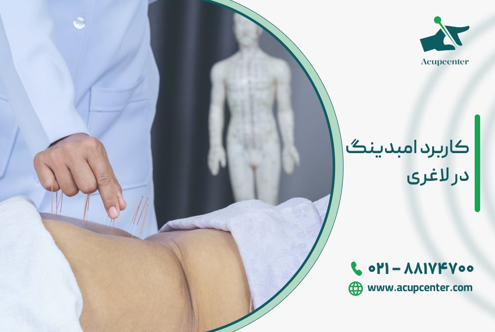 کاربرد امبدینگ در لاغری