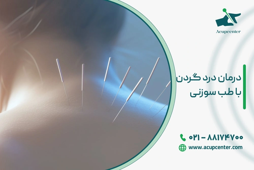 درمان درد گردن با طب سوزنی