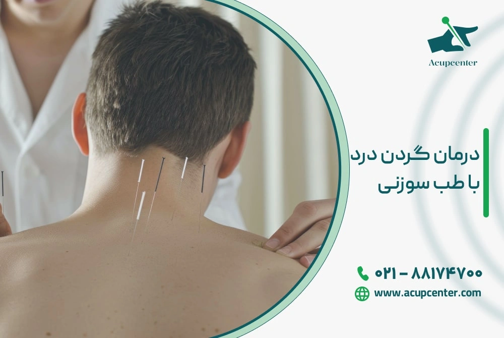 درمان گردن درد با طب سوزنی