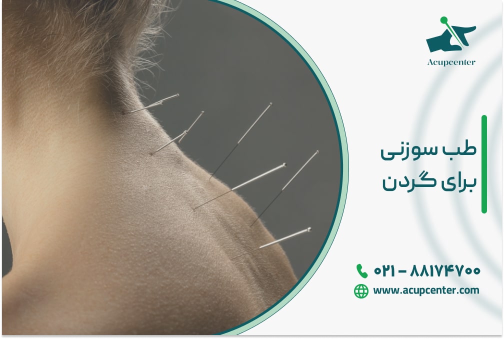 طب سوزنی برای گردن