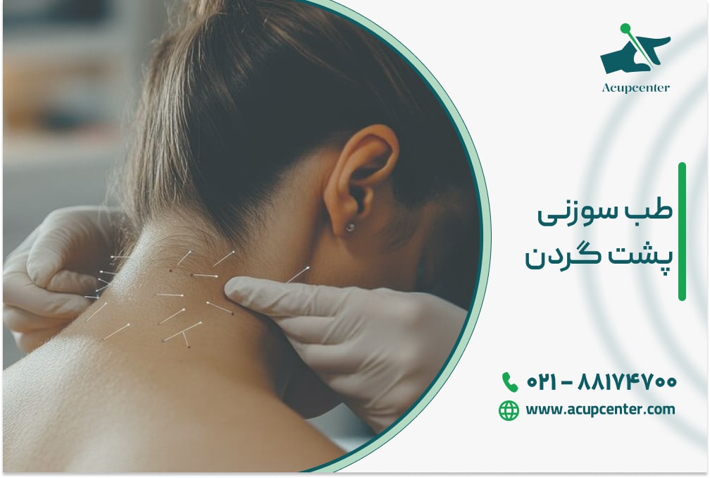 طب سوزنی پشت گردن