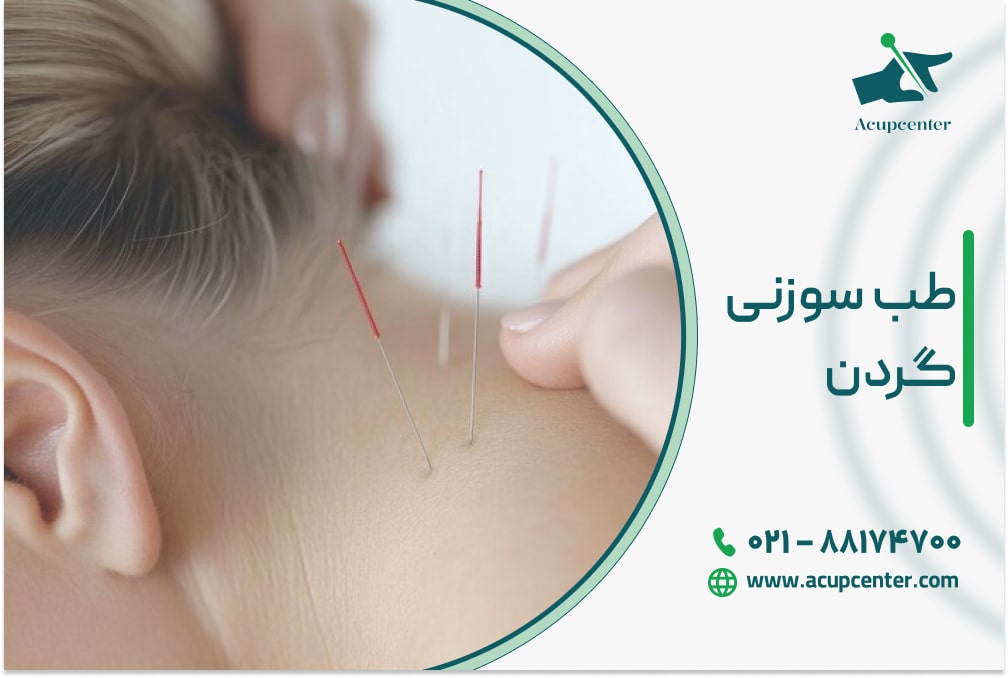 طب سوزنی گردن