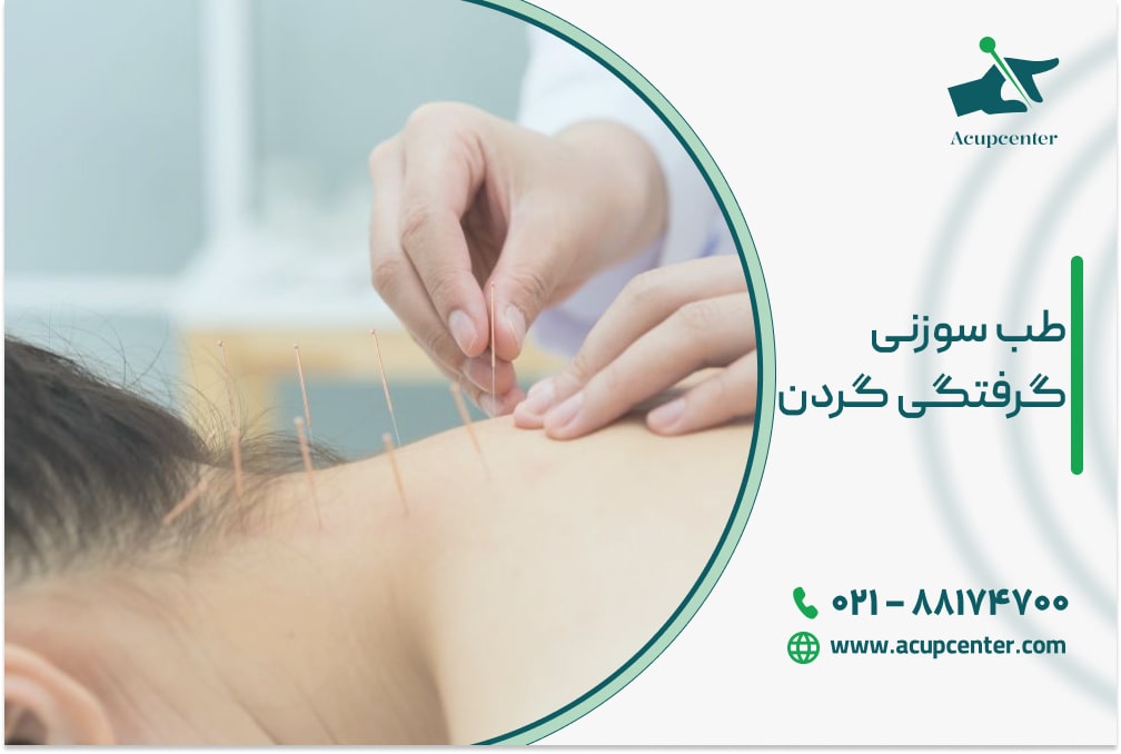 طب سوزنی گرفتگی گردن