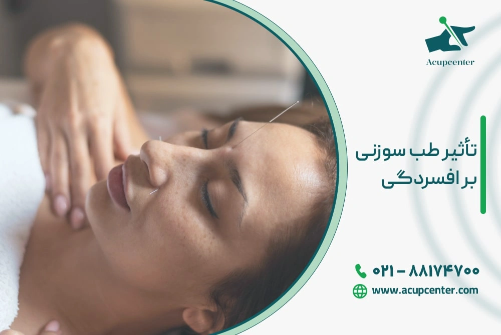 تأثیر طب سوزنی بر افسردگی