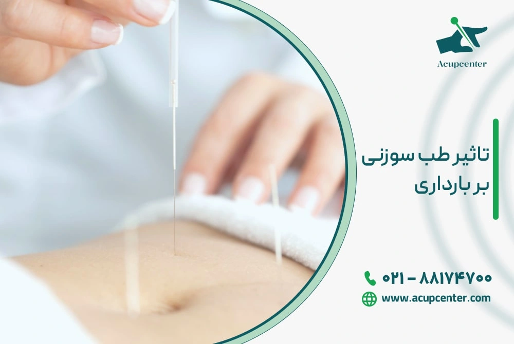تاثیر طب سوزنی بر بارداری