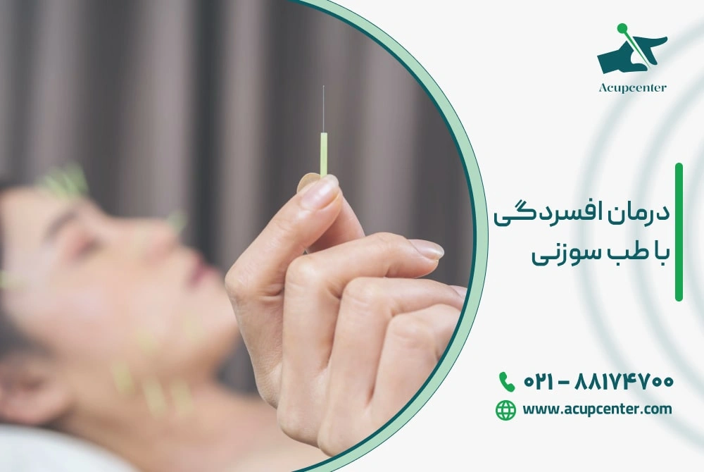 درمان افسردگی با طب سوزنی