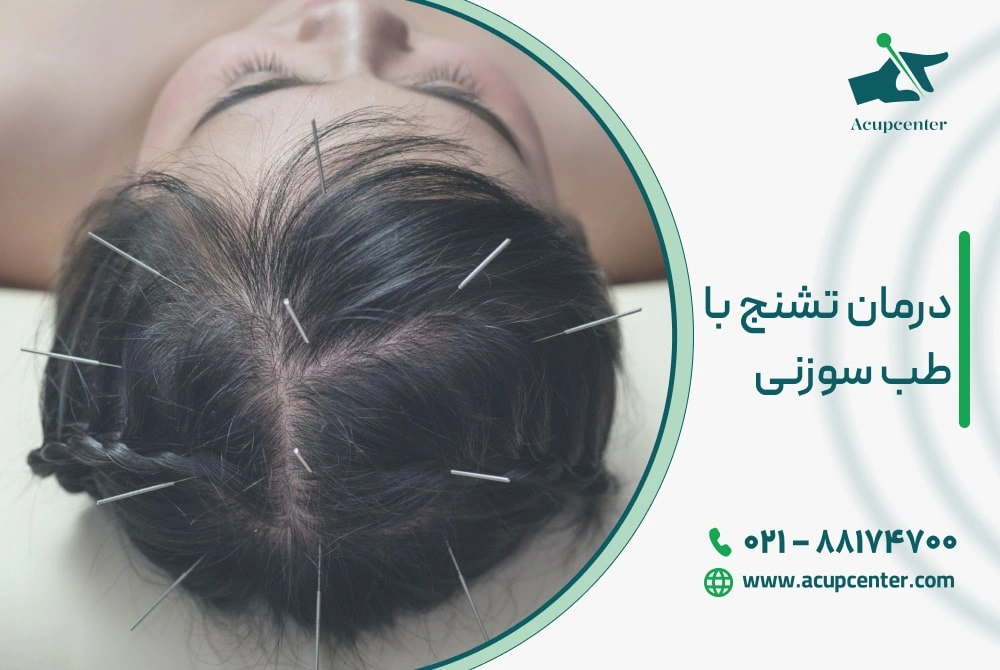 درمان تشنج با طب سوزنی