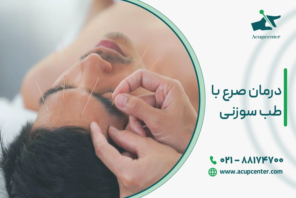 درمان صرع با طب سوزنی