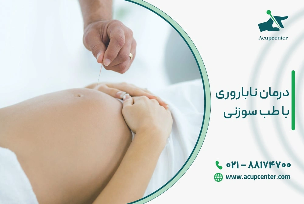 درمان ناباروری با طب سوزنی