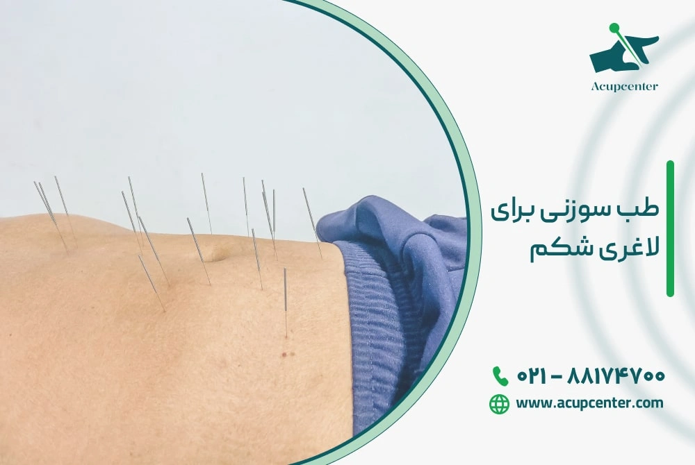 طب سوزنی برای لاغری شکم
