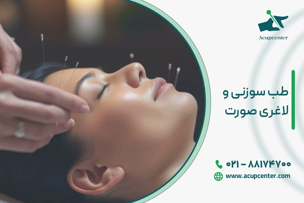 طب سوزنی و لاغری صورت