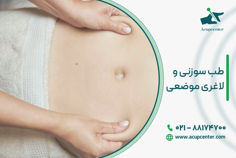 طب سوزنی و لاغری موضعی