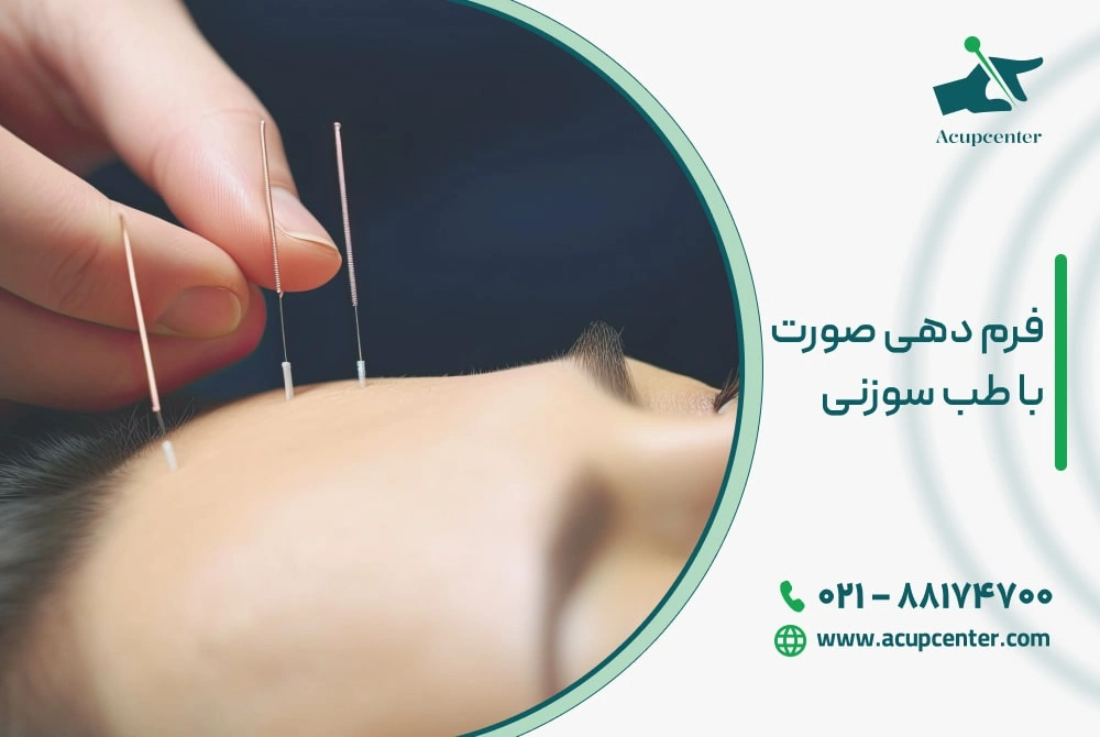 فرم دهی صورت با طب سوزنی