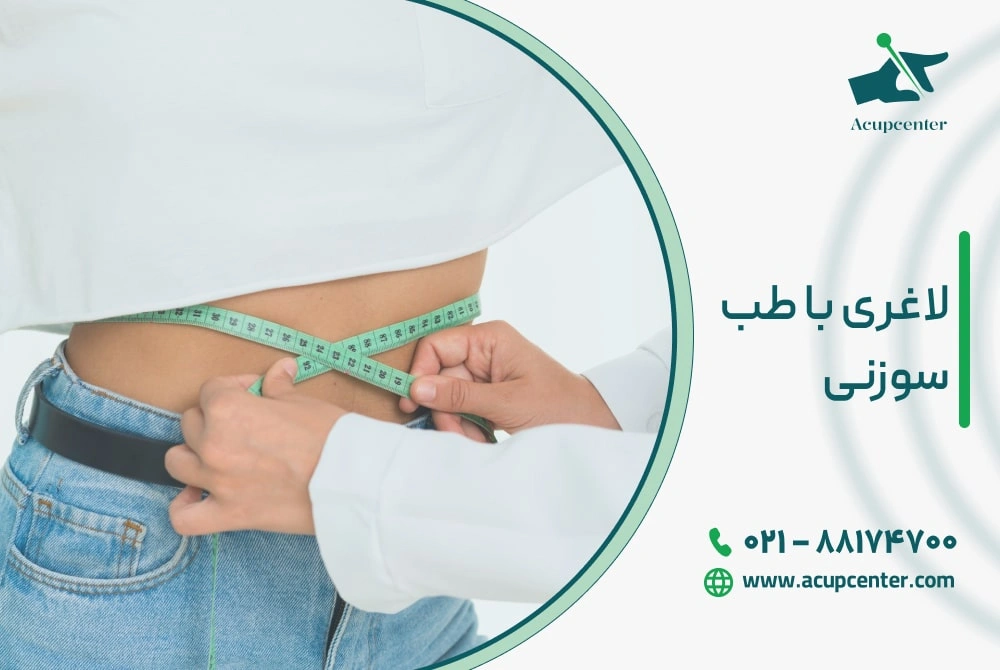 لاغری با طب سوزنی