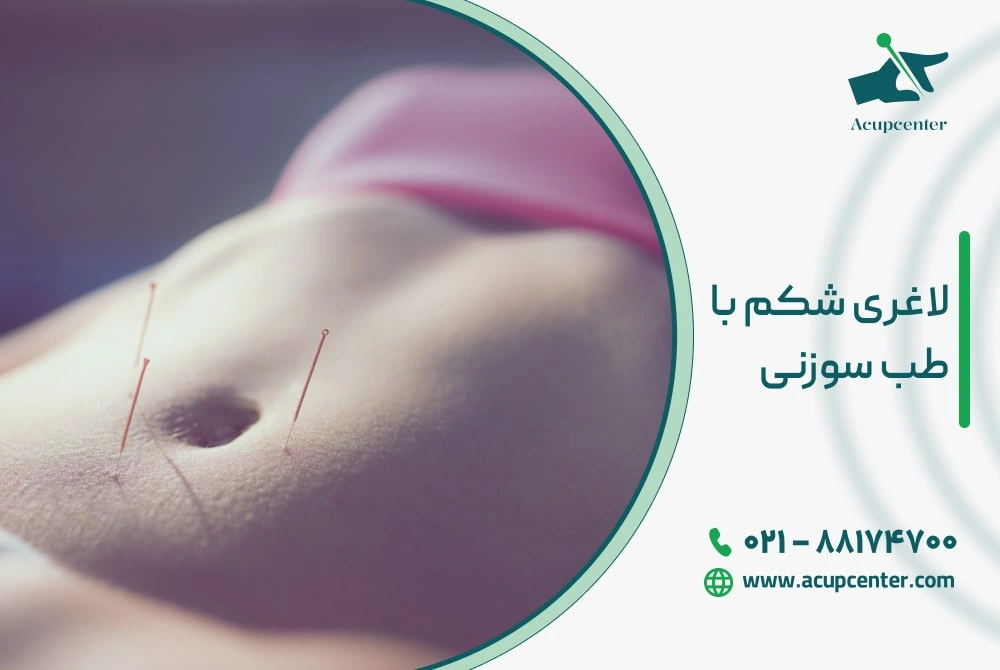 لاغری شکم با طب سوزنی