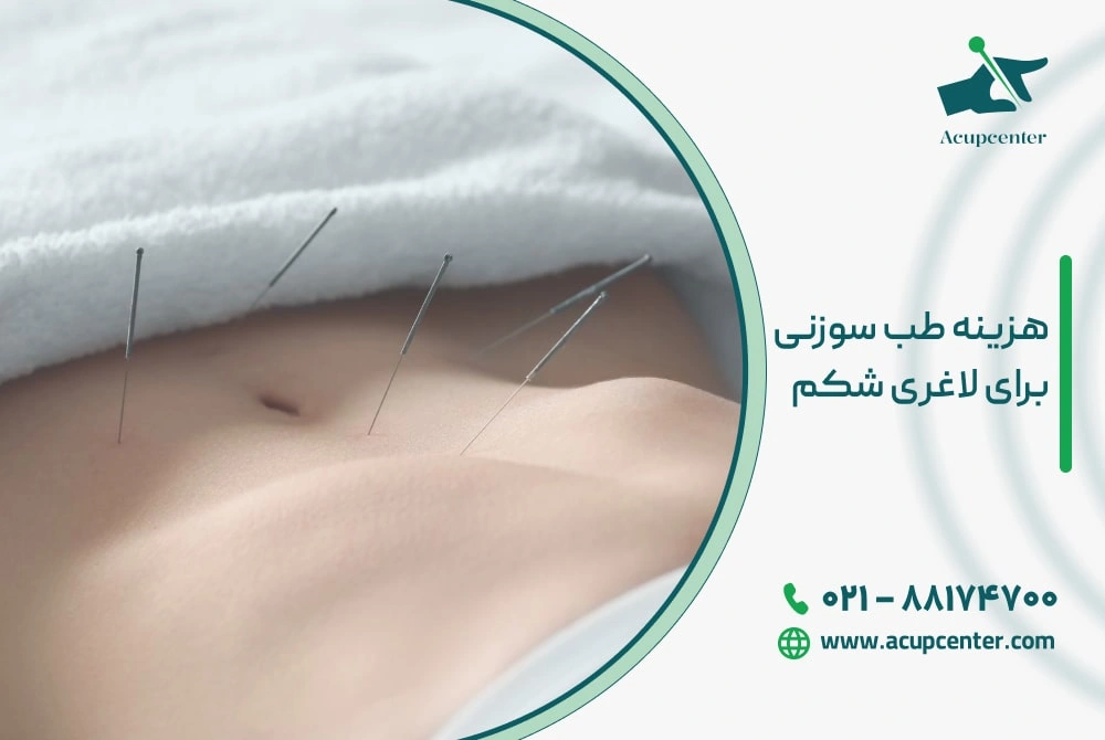 هزینه طب سوزنی برای لاغری شکم