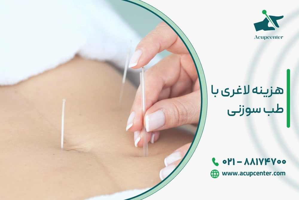 هزینه لاغری با طب سوزنی