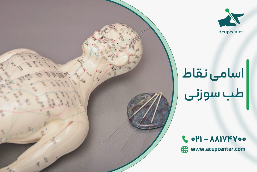 اسامی نقاط طب سوزنی