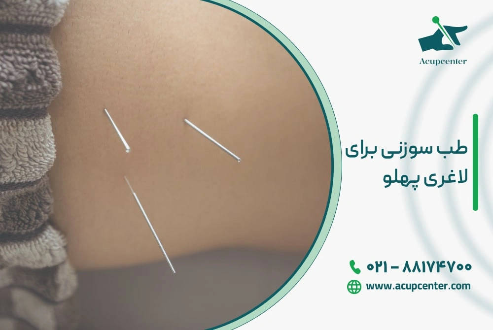 طب سوزنی برای لاغری پهلو