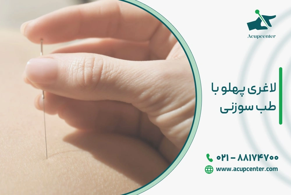 لاغری پهلو با طب سوزنی