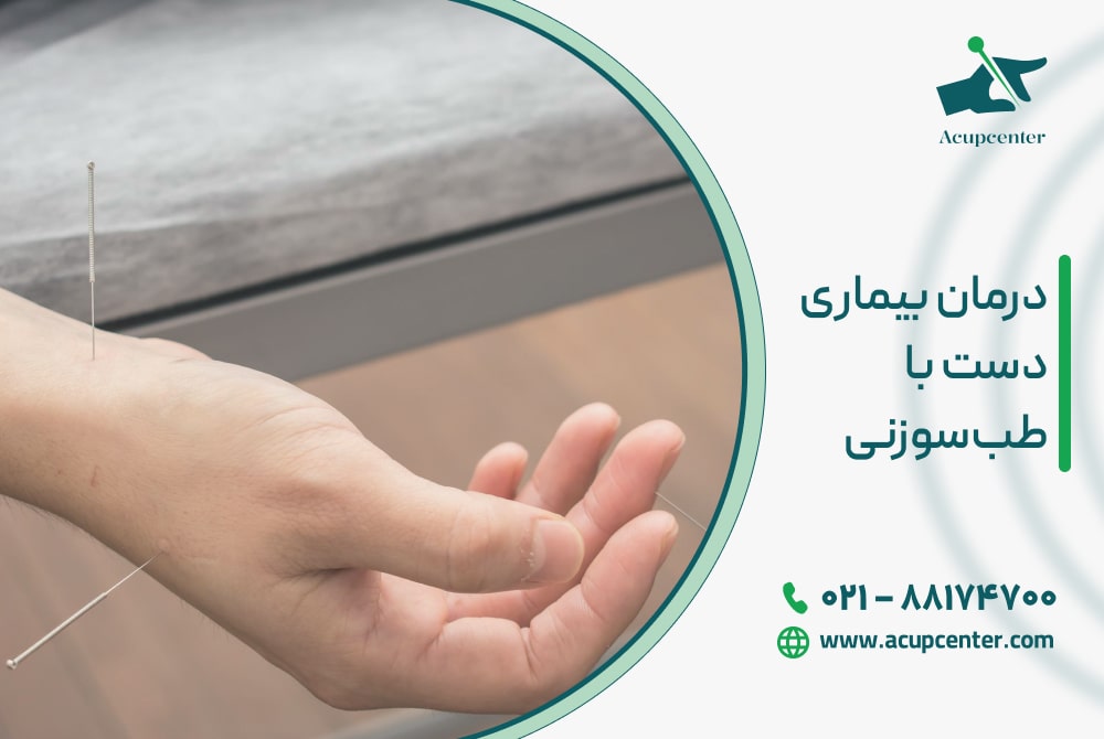 درمان بیماری‌های دست با طب‌سوزنی