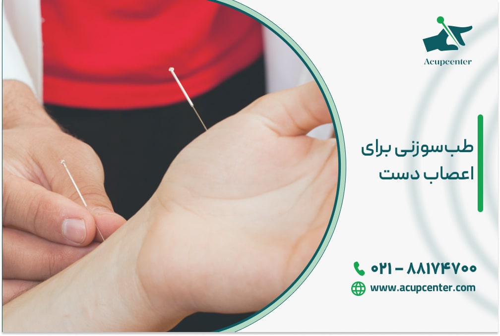 طب‌ سوزنی برای اعصاب دست