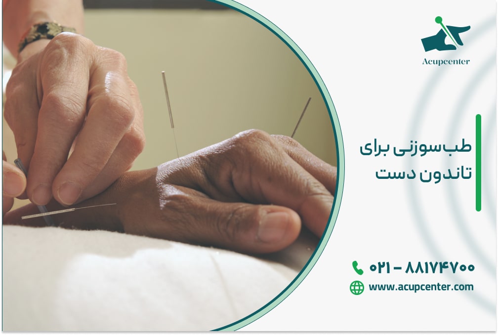 طب‌ سوزنی برای تاندون دست