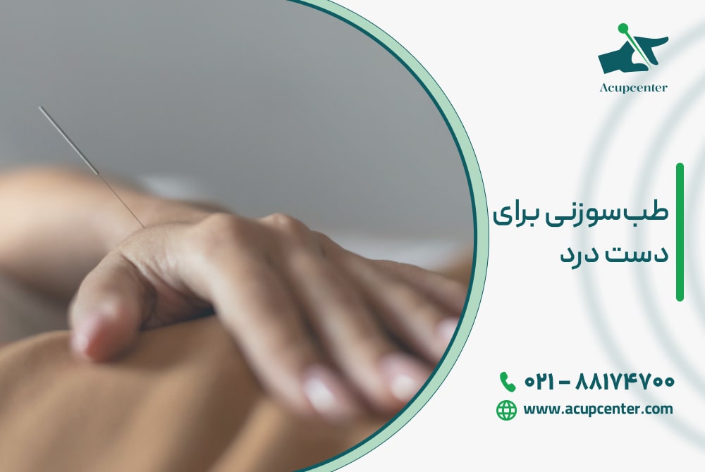 طب‌سوزنی برای دست‌ درد