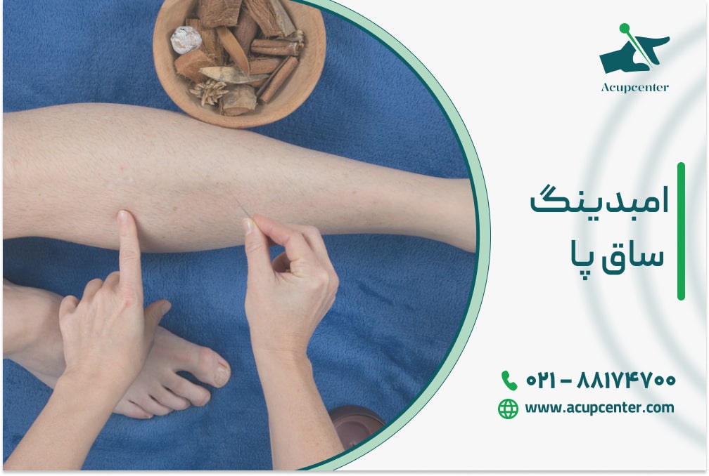 امبدینگ ساق پا