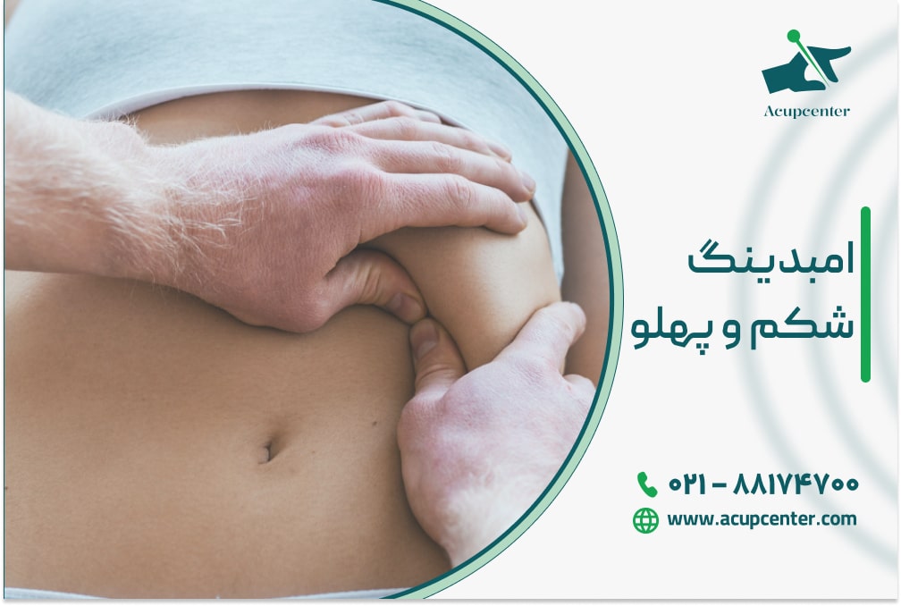 امبدینگ شکم و پهلو
