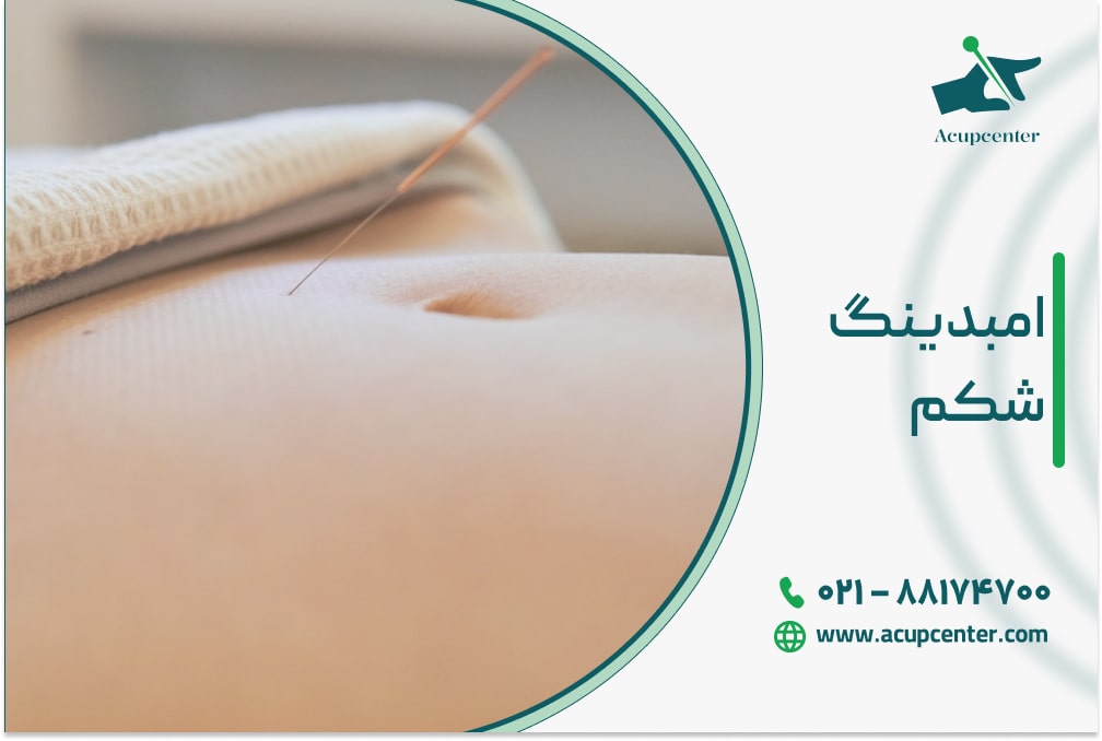 امبدینگ شکم