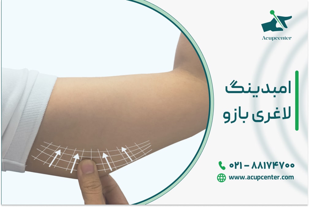 امبدینگ لاغری بازو