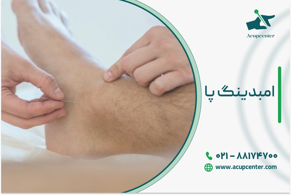 امبدینگ پا