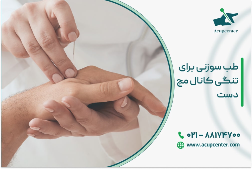 طب سوزنی برای تنگی کانال مچ دست