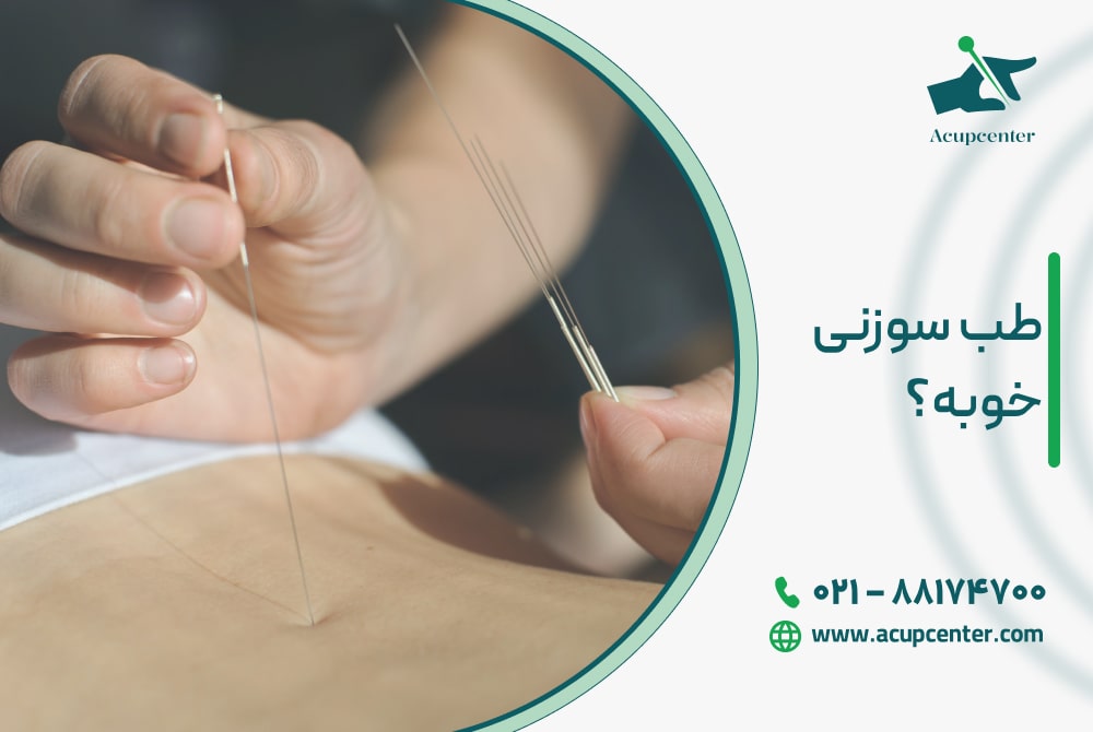 طب سوزنی خوبه؟