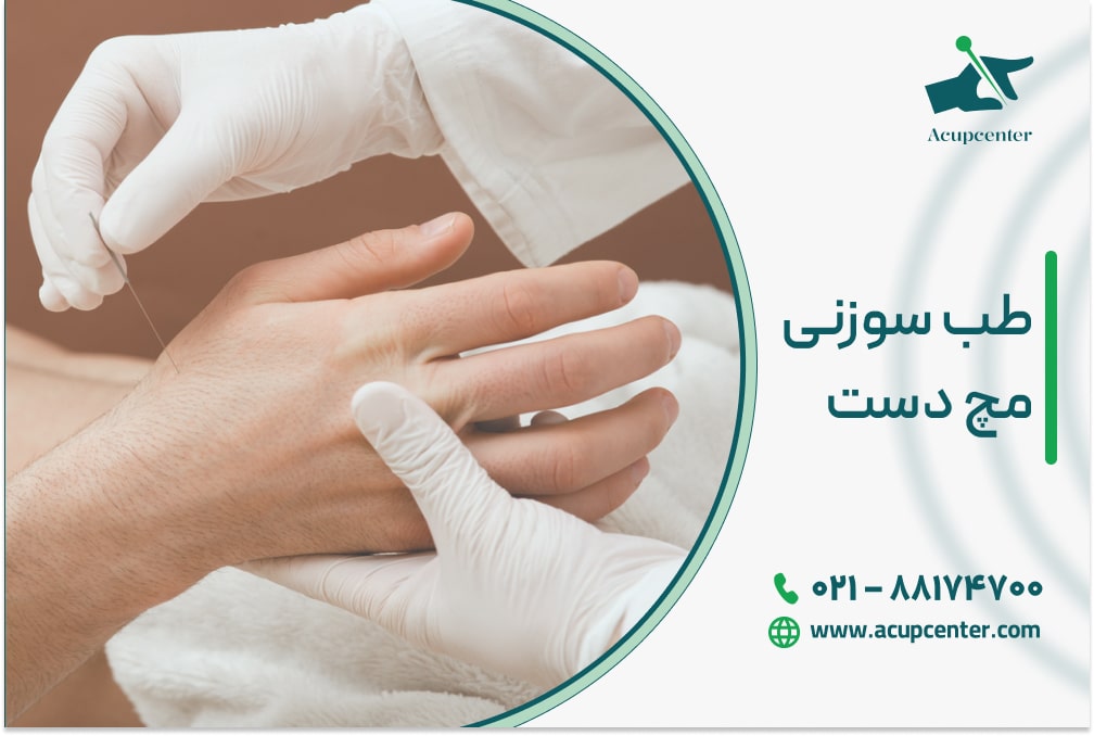 طب سوزنی مچ دست
