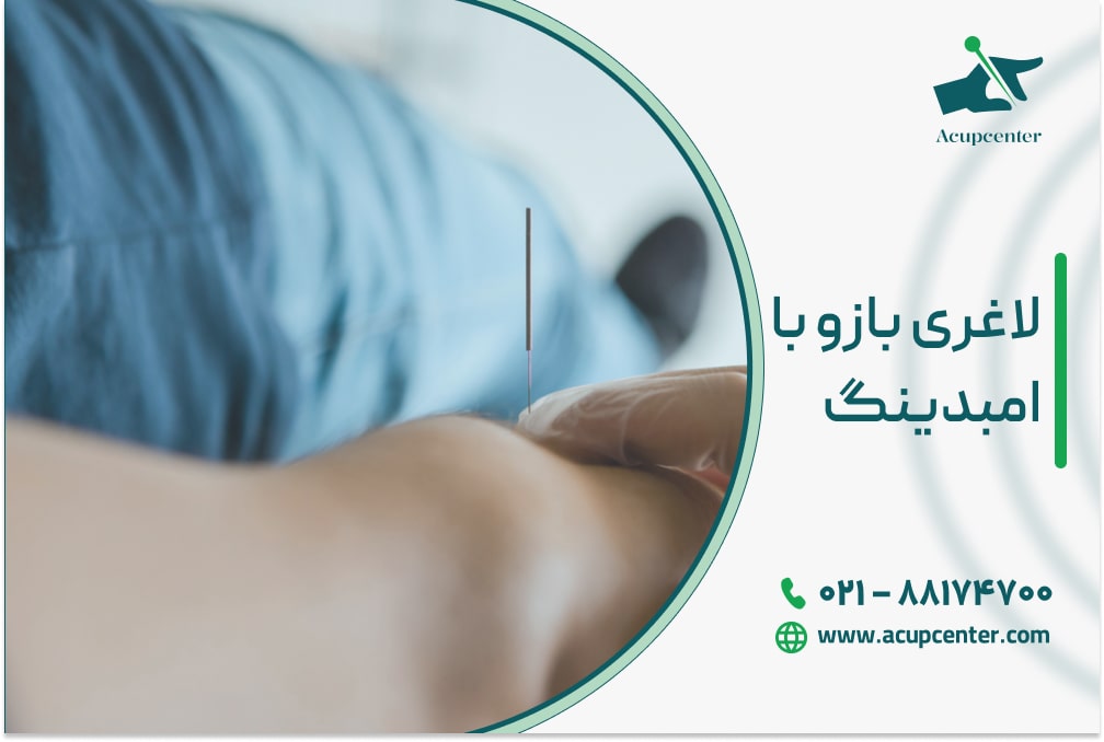 لاغری بازو با امبدینگ