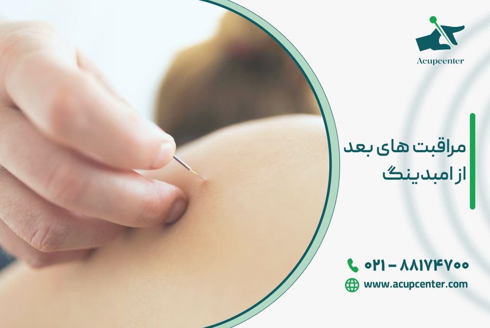مراقبت های بعد از امبدینگ