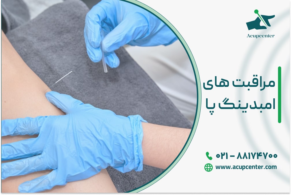 مراقبت‌ های قبل و بعد از امبدینگ پا