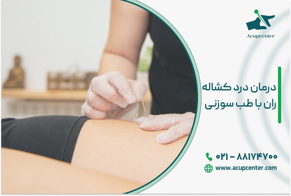 درمان درد کشاله ران با طب سوزنی