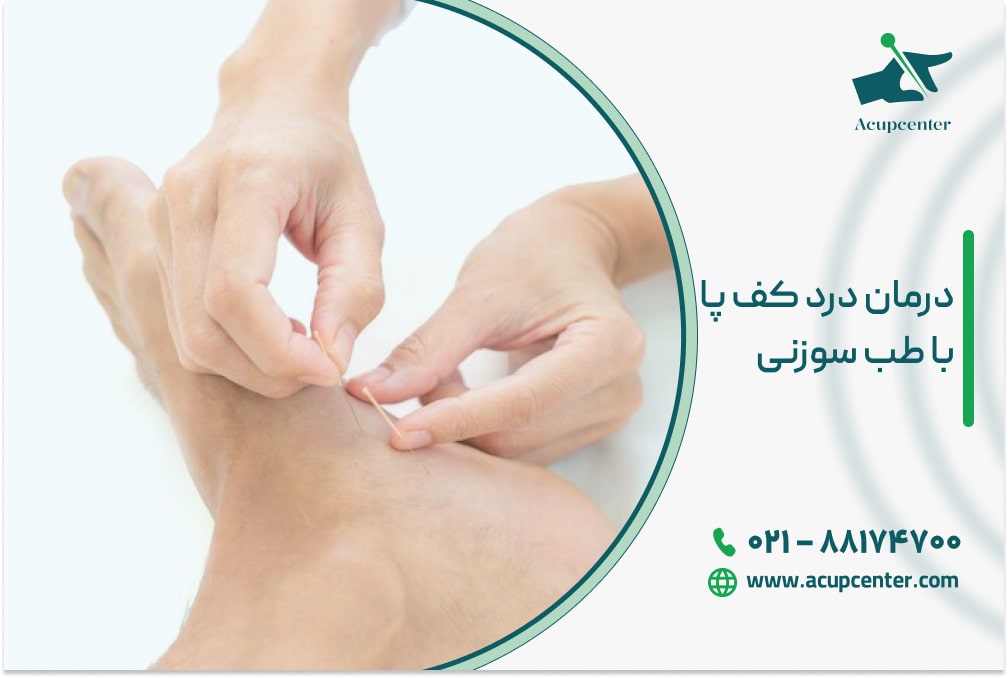 درمان درد کف پا با طب سوزنی