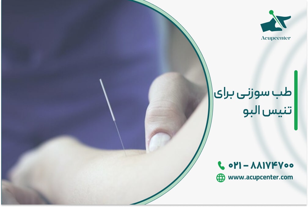 طب سوزنی برای تنیس البو