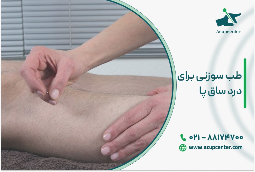 طب سوزنی برای درد ساق پا