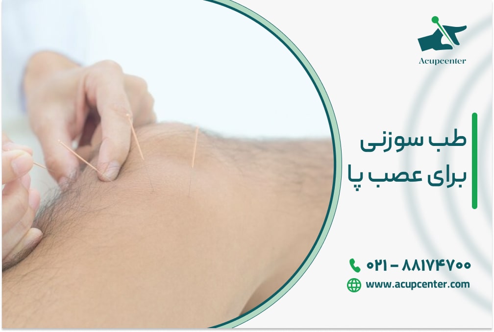 طب سوزنی برای عصب پا