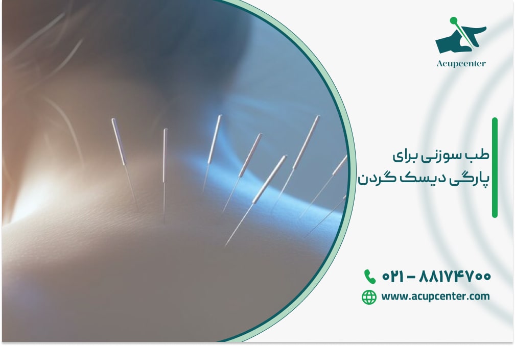 طب سوزنی برای پارگی دیسک گردن