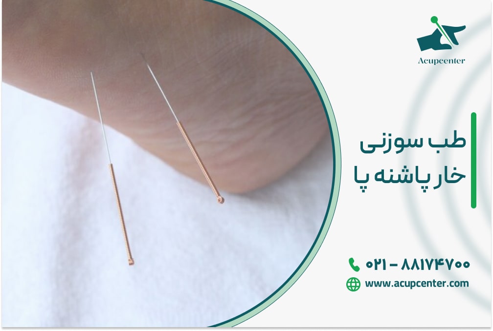 طب سوزنی خار پاشنه پا