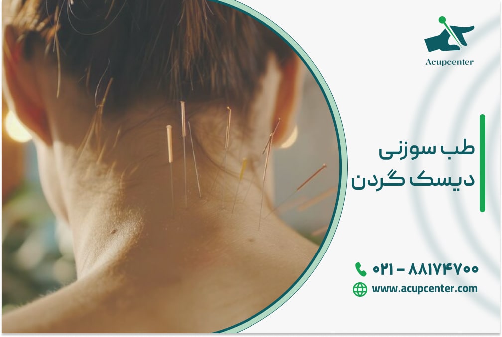 طب سوزنی دیسک گردن