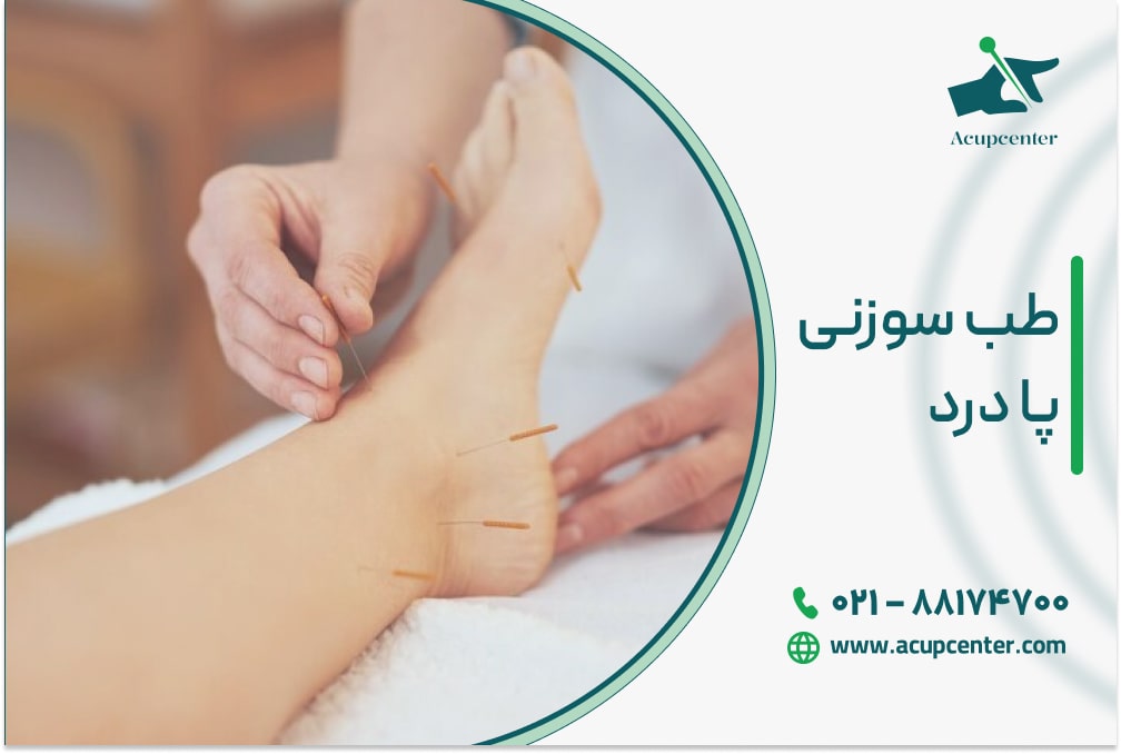 طب سوزنی پا درد