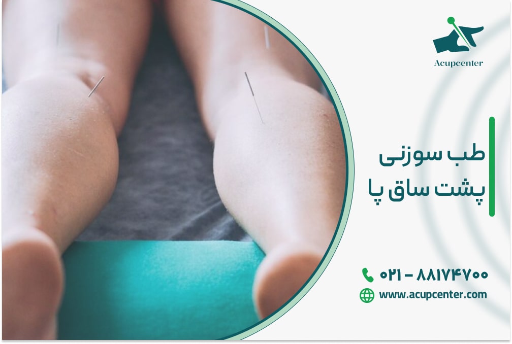 طب سوزنی پشت ساق پا